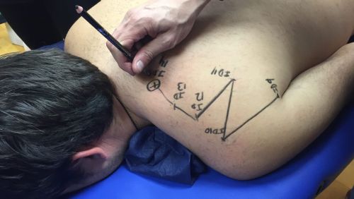 ACUPUNTURA CLÍNICA Y ELECTROACUPUNTURA FUNCIONAL PARA FISIOTERAPEUTAS (Madrid) Diciembre - Imagen 3