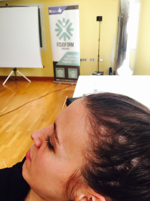 ACUPUNTURA CLÍNICA Y ELECTROACUPUNTURA FUNCIONAL PARA FISIOTERAPEUTAS (Madrid) Diciembre - Imagen 8