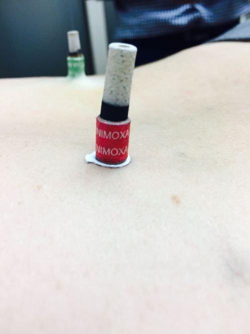 ACUPUNTURA CLÍNICA Y ELECTROACUPUNTURA FUNCIONAL PARA FISIOTERAPEUTAS (Madrid) Diciembre - Imagen 18