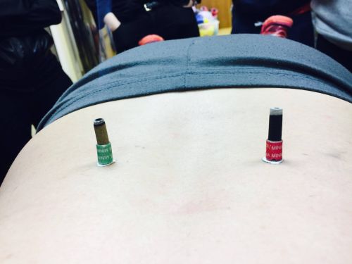 ACUPUNTURA CLÍNICA Y ELECTROACUPUNTURA FUNCIONAL PARA FISIOTERAPEUTAS (Madrid) Diciembre - Imagen 2