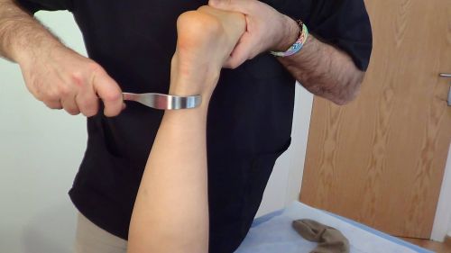 ABORDAJE INSTRUMENTAL CON GANCHOS: Tratamiento neuromusculoesquelético (Córdoba) Octubre - Imagen 3