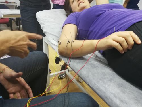 ELECTROACUPUNTURA FUNCIONAL Avanzada Octubre (Alicante) - Imagen 3
