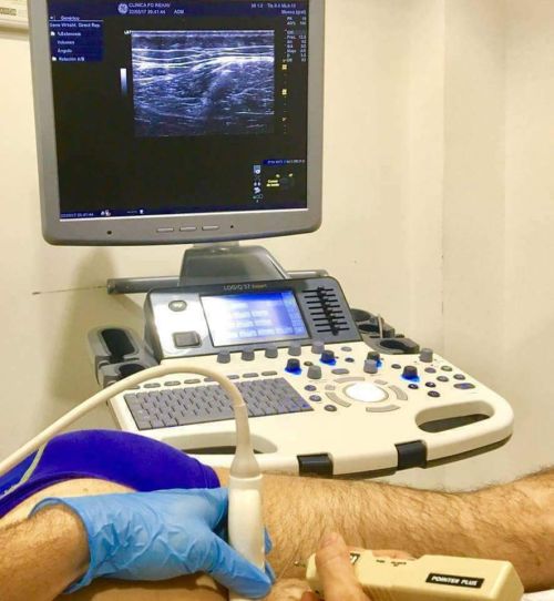 NEUROMODULACIÓN PERCUTÁNEA - Imagen 4