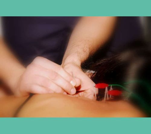 NEUROMODULACIÓN PERCUTÁNEA