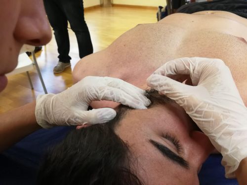 Curso de Punción Seca y Electropunción Las Palmas - Aplicada a Patología Clínica <h2>Las Palmas - 15 y 16 de marzo </h2> - Imagen 4