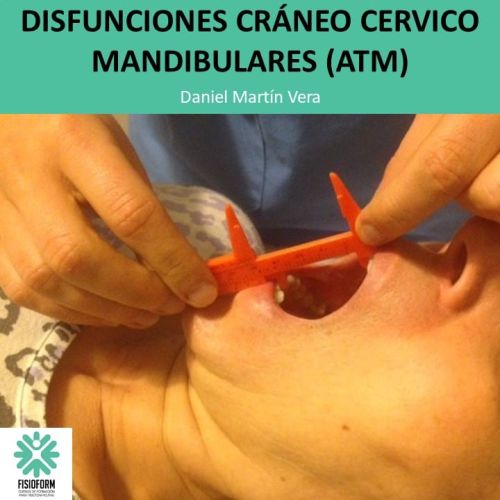 Fisioterapia en las disfunciones cráneo-cervico-mandibulares (ATM) Mayo (Alicante)