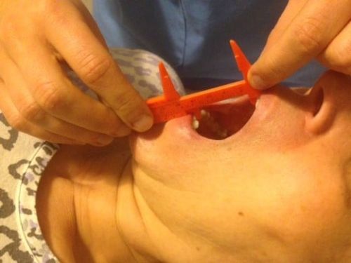 Fisioterapia en las disfunciones cráneo-cervico-mandibulares (ATM) Mayo (Alicante) - Imagen 2