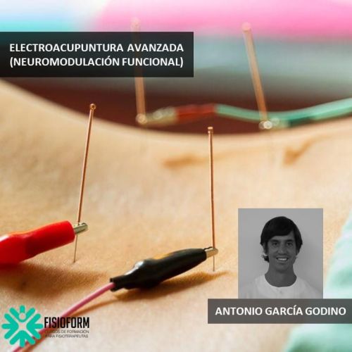 ELECTROACUPUNTURA  AVANZADA (Neuromodulación funcional) Diciembre (Navarra)