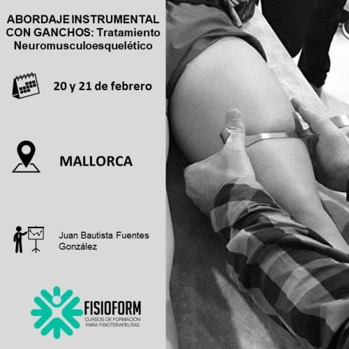 ABORDAJE INSTRUMENTAL CON GANCHOS: Tratamiento neuromusculoesquelético (Mallorca) Febrero
