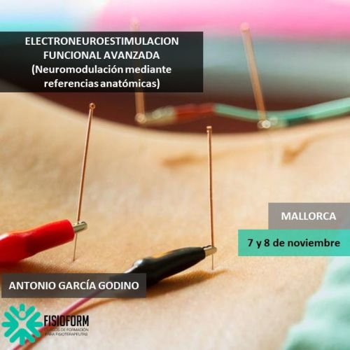 ELECTRONEUROESTIMULACION FUNCIONAL AVANZADA (Neuromodulación mediante referencias anátomicas) Noviembre (Mallorca)