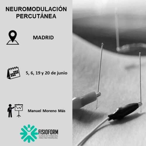NEUROMODULACIÓN PERCUTÁNEA Junio (Madrid)