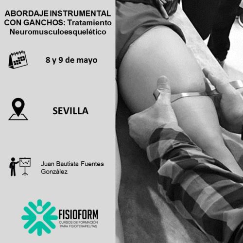 ABORDAJE INSTRUMENTAL CON GANCHOS: Tratamiento neuromusculoesquelético (Sevilla) Mayo