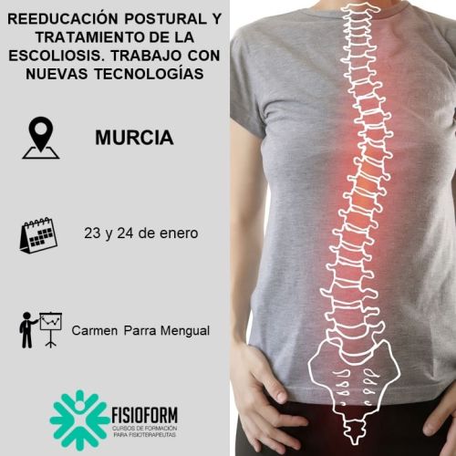 REEDUCACIÓN POSTURAL Y TRATAMIENTO DE LA ESCOLIOSIS. TRABAJO CON NUEVAS TECNOLOGÍAS Enero (Murcia)