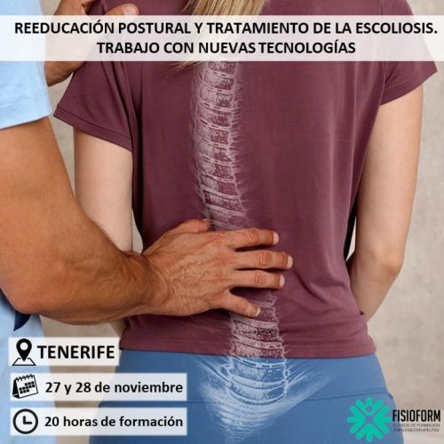 REEDUCACIÓN POSTURAL Y TRATAMIENTO DE LA ESCOLIOSIS. TRABAJO CON NUEVAS TECNOLOGÍAS Noviembre (Tenerife)