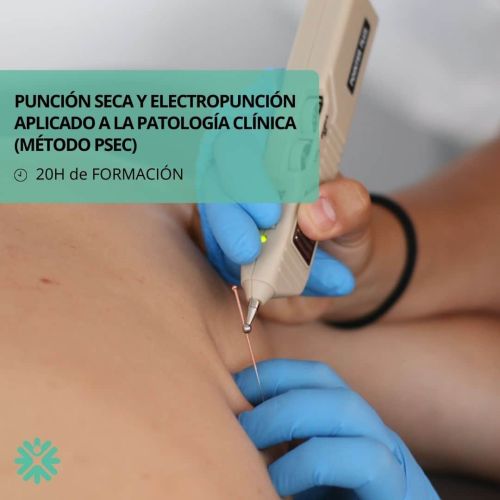 Curso Punción Seca y Electropunción