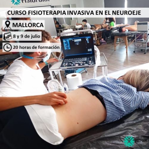 Fisioterapia Invasiva en el Neuroeje Mallorca