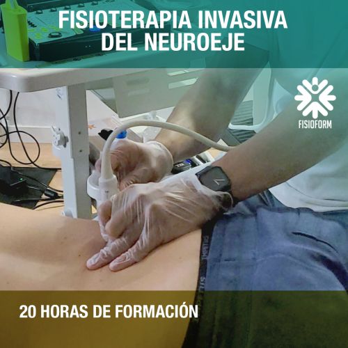 Curso Fisioterapia Invasiva del Neuroeje