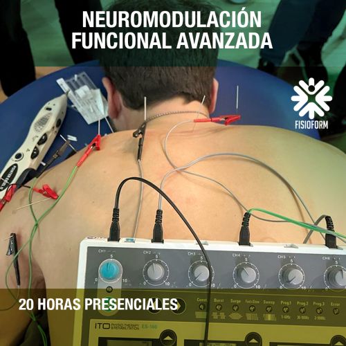 Neuromodulación Funcional Avanzada en Bilbao