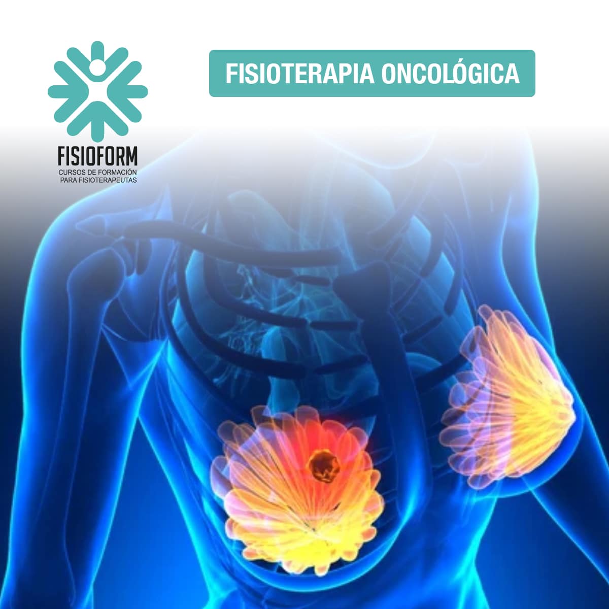 Sorteo-1_oncologica