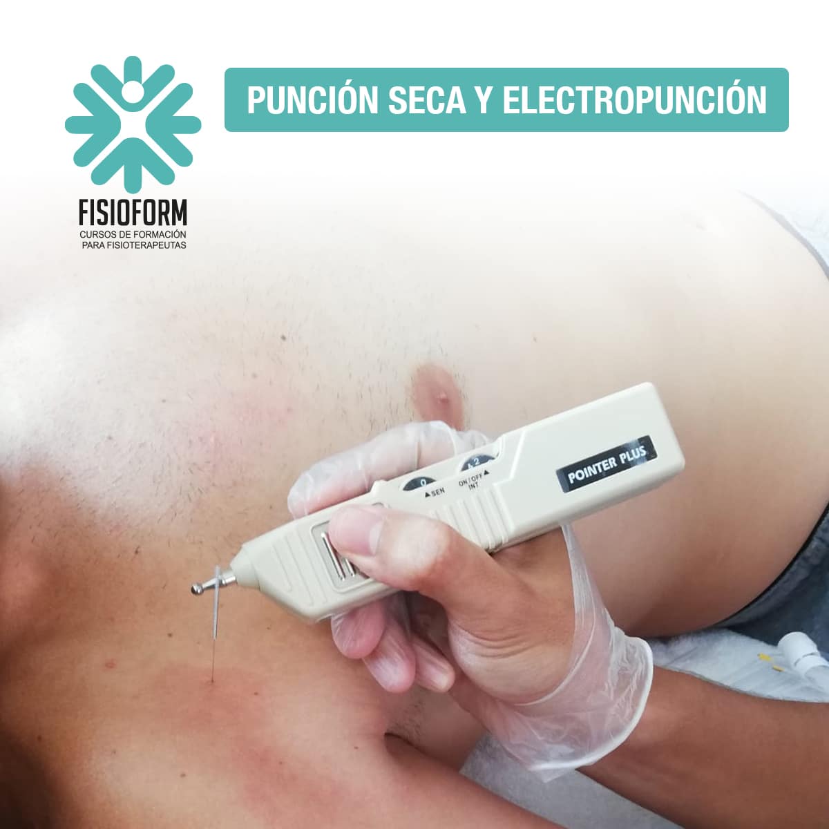 Sorteo-1_puncion-seca