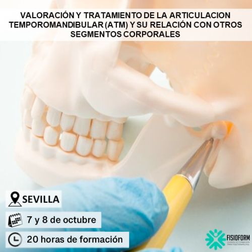 Articulación Temporomandibular ATM Sevilla