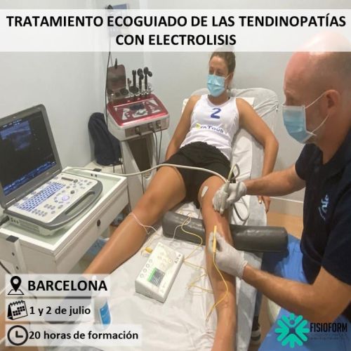 Tratamiento Ecoguiado Tendinopatías con Electrólisis