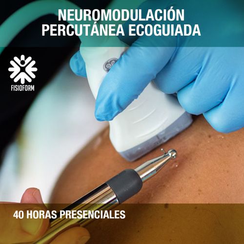 Neuromodulación Percutánea Ecoguiada