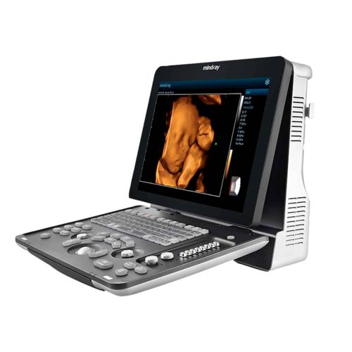 Ecógrafo Mindray Z60 lateral