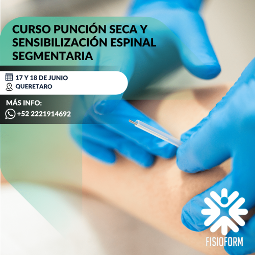Punción Seca