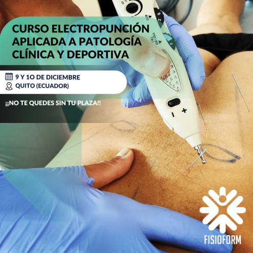 Curso de Electropunción Quito