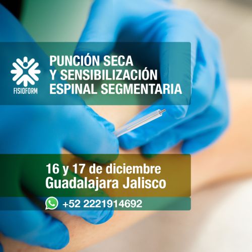 Curso de Punción Seca y Sensibilización Espinal Segmentaria - Guadalajara Jalisco