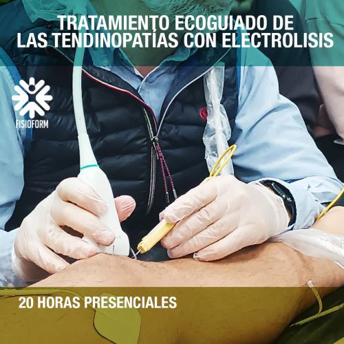 Tratamiento Ecoguiado de las Tendinopatías con Electrolisis