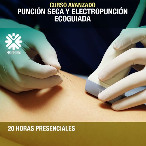 Curso Avanzado Punción Seca y Electropunción Ecoguiada