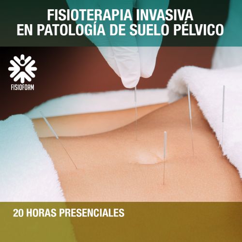 Fisioterapia Invasiva en patología de Suelo Pélvico