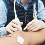 Tratamiento ecoguiado de las tendinopatías con electrolisis