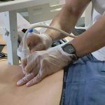 Fisioterapia invasiva del neuroje