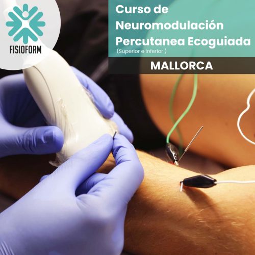 Curso de Neuromodulación percutánea ecoguiada I y II - 40 Horas - Superior + Inferior <h2>MALLORCA - Del 17 mayo al 1 de junio de 2025</h2>
