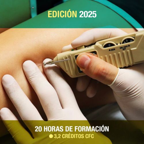 Curso de Punción Seca y Electropunción A Coruña - Aplicada a Patología Clínica<h2>A Coruña - 7 y 8 de junio</h2> - Imagen 8